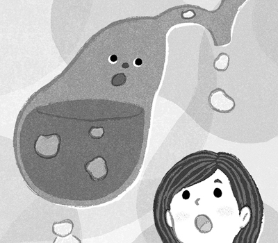 胆石症とのつき合い方